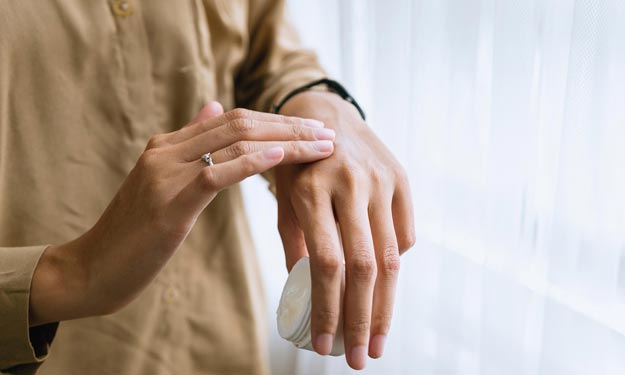 Woman With Dyshidrotic Eczema Applying Natural Lotion to Hands.
